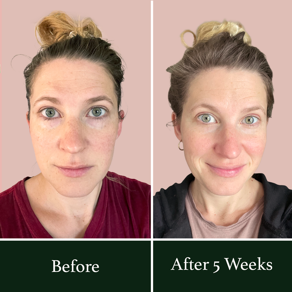 <h2>Loved by real skin.</h2><h2>Real Results. Real People.</h2>