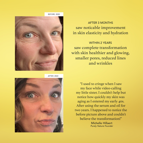 Radiant Skincare Renewal Serum Set